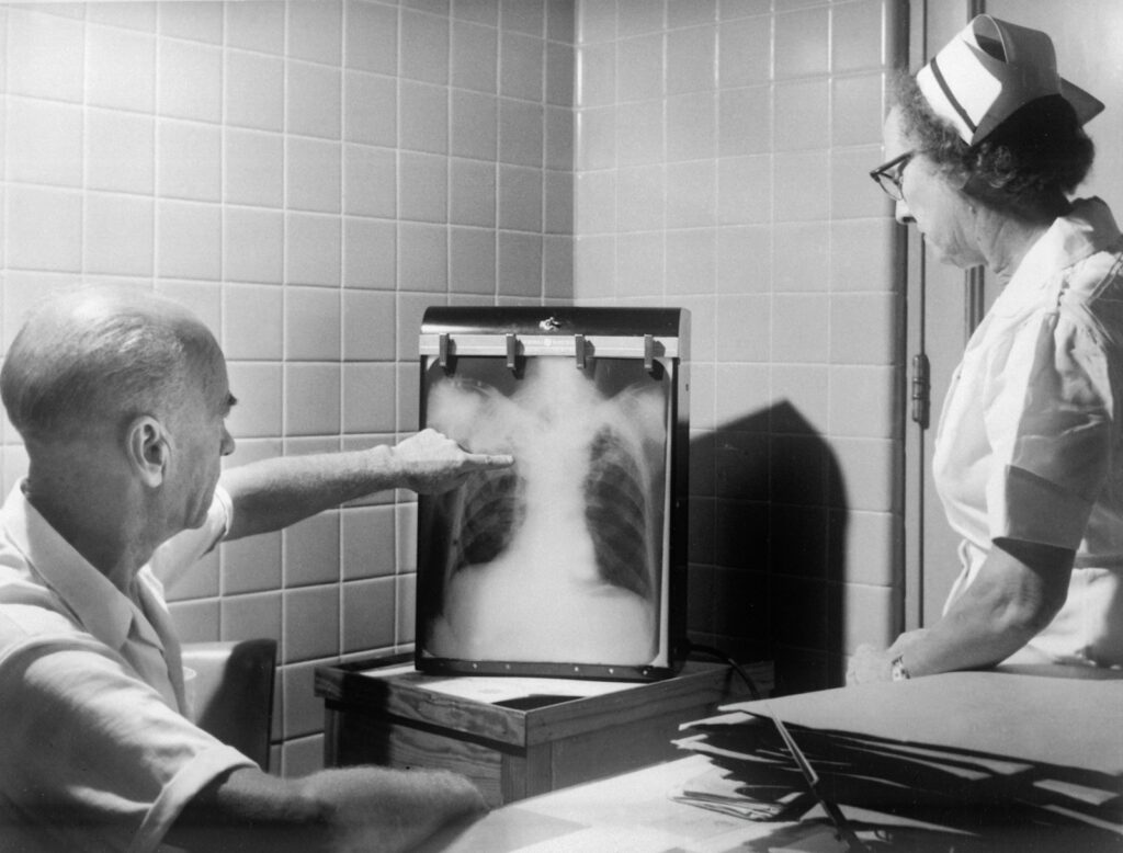 Physicians reviewing a digital chest X-ray